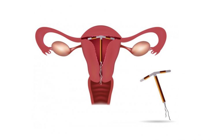 family-planning