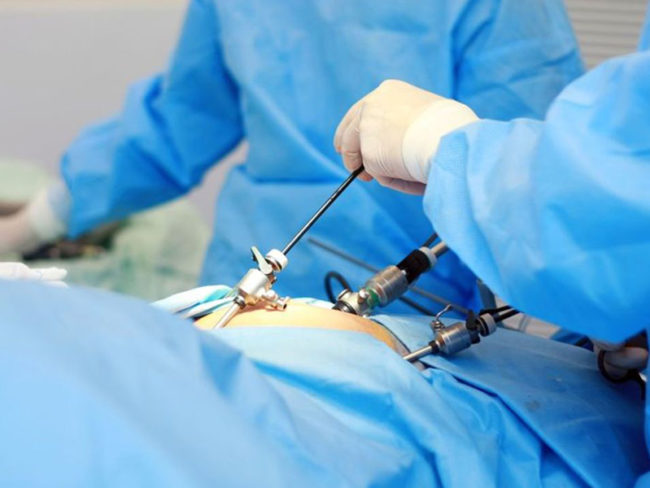 laparoscopy-clinic