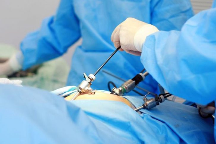 laparoscopy-clinic