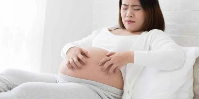 Itching In Pregnancy Itching-In-Pregnancy