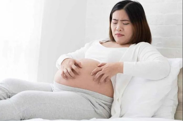 Itching-In-Pregnancy