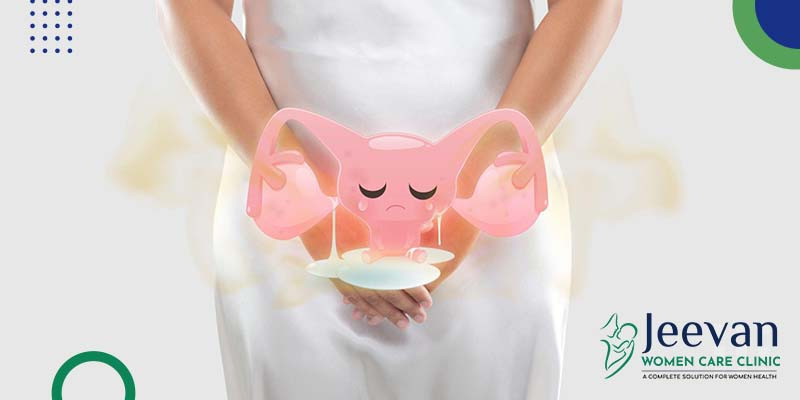 Leucorrhea-Jeevan Leucorrhea