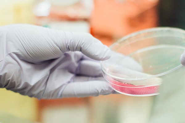 Infertility-test-results-Jeevan