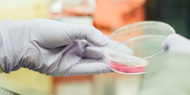 Infertility test results-Jeevan Infertility-test-results-Jeevan