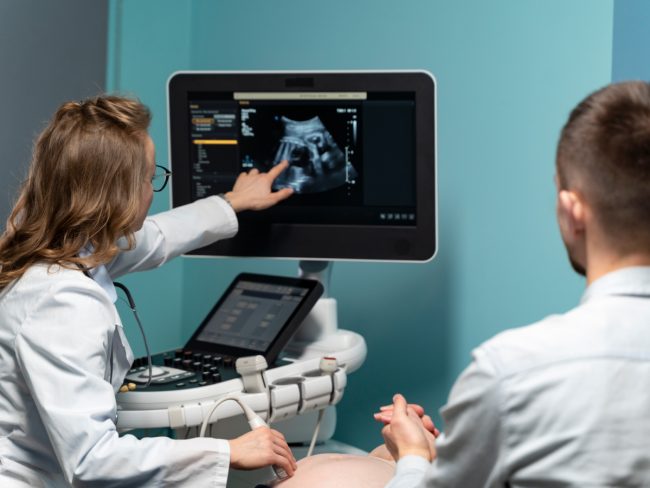 Fetal movement monitoring_best ivf centre chennai_jeevanwomen_ivf chennai