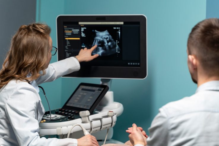 Fetal movement monitoring_best ivf centre chennai_jeevanwomen_ivf chennai