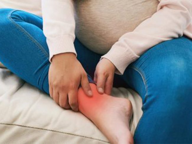 swelling in pregnancy